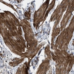 URG4 Antibody, Novus Biologicals:Antibodies:Primary Antibodies